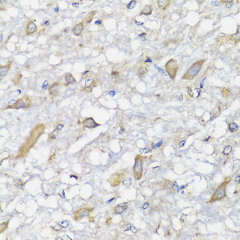 Anti-SPICE1 Antibody (CAB7855)