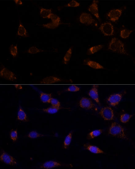 Anti-MTCH2 Antibody (CAB12934)