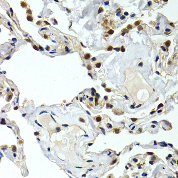 Anti-GTF2F1 Antibody (CAB2489)