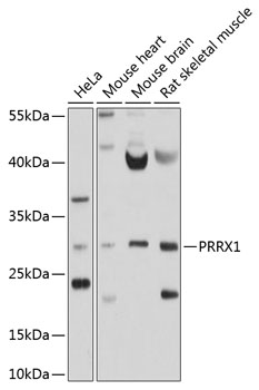 Anti-PRRX1 Antibody (CAB10237)