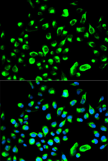 Anti-YWHAQ Antibody (CAB2563)