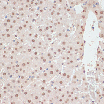 Anti-Phospho-PRKAA1-T183/PRKAA2-T172 Antibody (CABP0116)