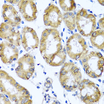 Anti-M6PR Antibody (CAB6296)