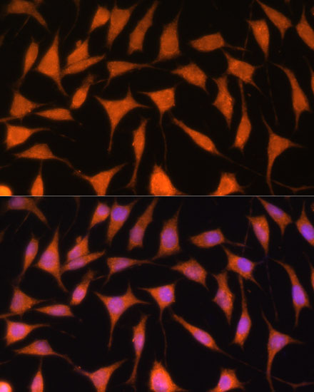 Anti-TIMM44 Antibody (CAB17446)