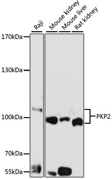 Anti-PKP2 Antibody (CAB5507)