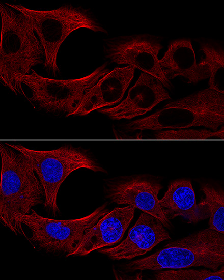 Anti-Alpha-Tubulin Antibody (CABC007)