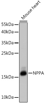 Anti-NPPA Antibody (CAB14755)