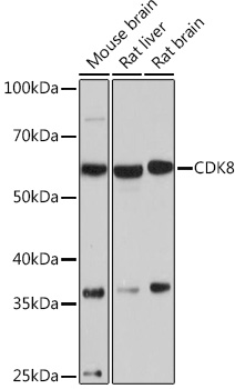 Anti-CDK8 Antibody (CAB9654)