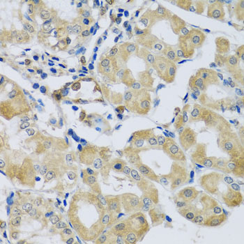 Anti-Synaptotagmin-11 Polyclonal Antibody (CAB8198)