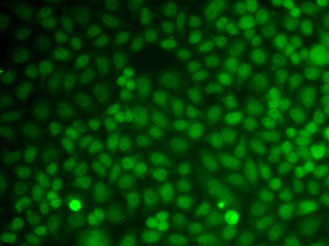 Anti-GADD45A Antibody (CAB13487)