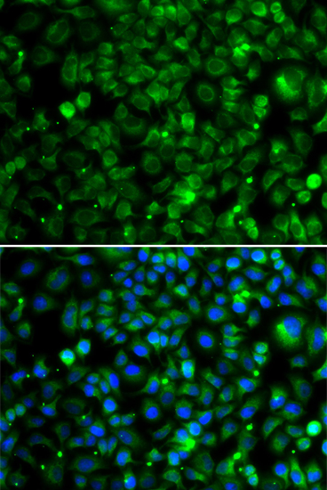 Anti-TMLHE Antibody (CAB7312)