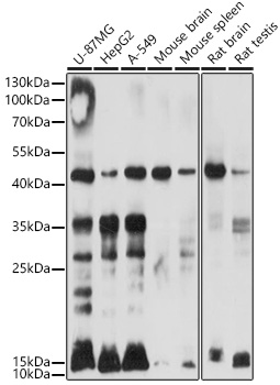 Anti-Ubiquitin Antibody (CAB18185)