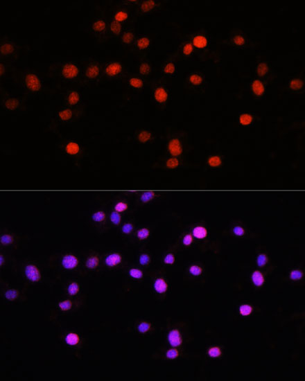 Anti-KLF8 Antibody (CAB16321)