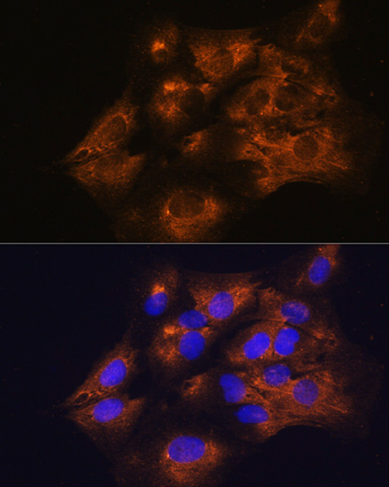 Anti-C1 Inactivator Antibody (CAB1717)