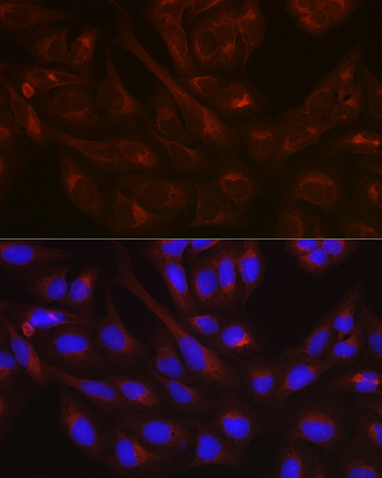 Anti-NSF Antibody (CAB0926)