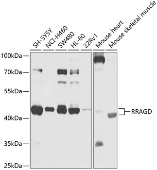 Anti-RRAGD Polyclonal Antibody (CAB9979)