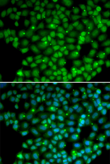 Anti-MUTYH Antibody (CAB1612)