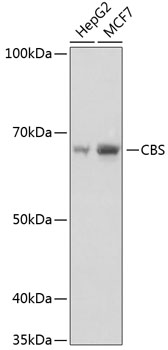 Anti-CBS Antibody