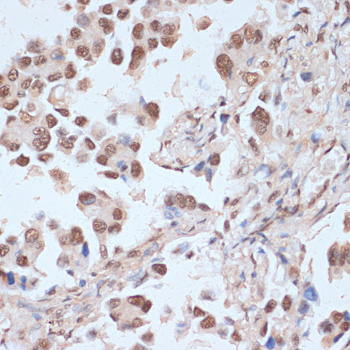 Anti-Phospho-PRKAA1-T183/PRKAA2-T172 Antibody (CABP0116)