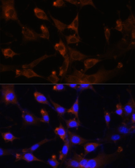 Anti-CAD protein Polyclonal Antibody (CAB8344)