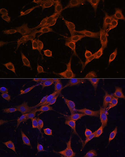 Anti-SQSTM1 / p62 Antibody (CAB7758)