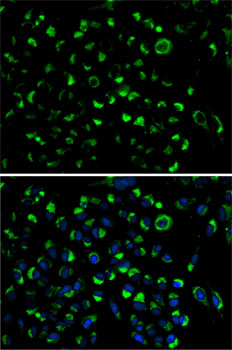 Anti-AK4 Antibody (CAB2050)