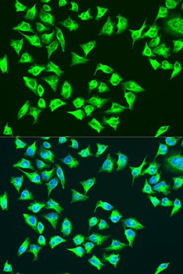 Anti-ATP6 Polyclonal Antibody (CAB8193)