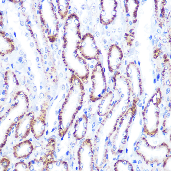 Anti-Smad4 Antibody (CAB5657)