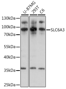 Anti-SLC6A3 Antibody (CAB15236)