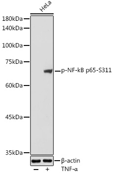 Anti-Phospho-RELA-S311 Antibody (CABP0445)