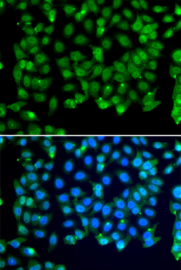 Anti-RNF8 Antibody (CAB14083)