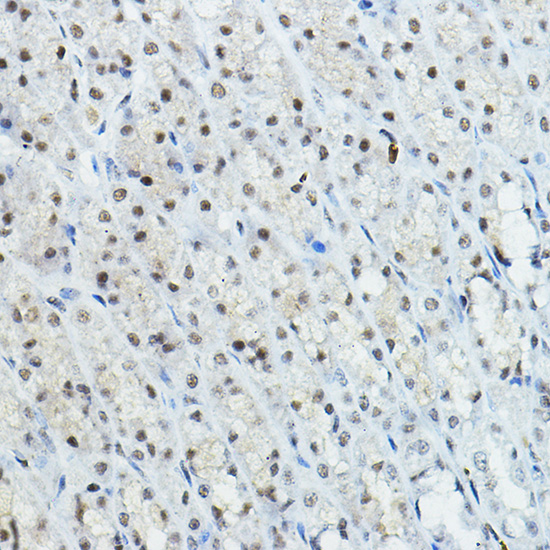 Anti-NCOR1 Antibody (CAB7046)