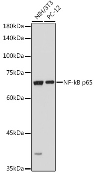 Anti-NF-kB p65 Antibody