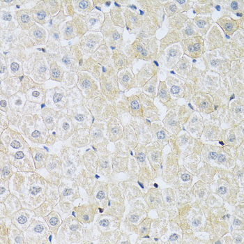 Anti-SLC4A5 Antibody (CAB10436)