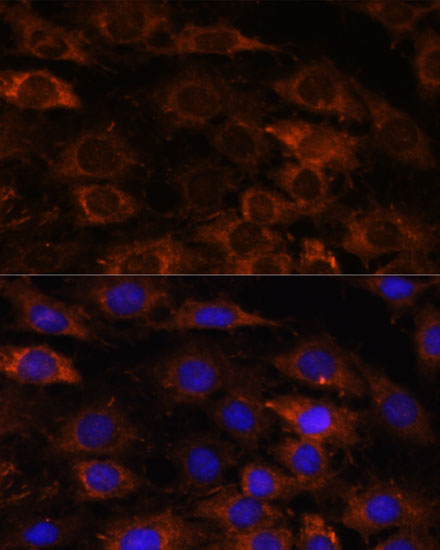 Anti-HEBP2 Antibody (CAB16504)