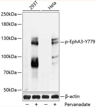 Anti-Phospho-EphA3-Y779 pAb (CABP0768)