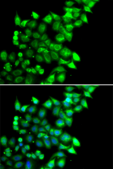 Anti-MEST Antibody (CAB6931)