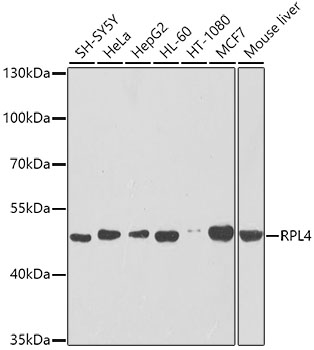 Anti-RPL4 Antibody (CAB5886)