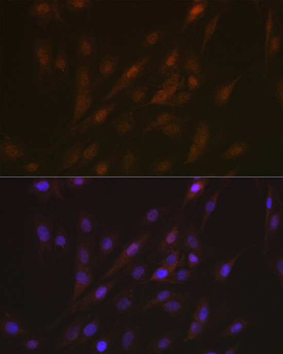 Anti-ASC / TMS1 Antibody (CAB16672)