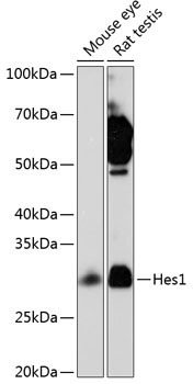 Anti-Hes1 Antibody