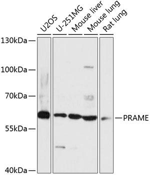 Anti-PRAME Antibody (CAB14507)