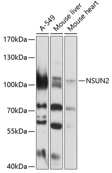 Anti-NSUN2 Antibody (CAB3443)