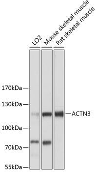 Anti-ACTN3 Antibody (CAB12864)