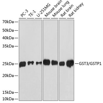 Anti-GST3 / GSTP1 Antibody (CAB19061)