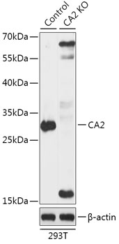 Anti-CA2 Antibody [KO Validated] (CAB18034)