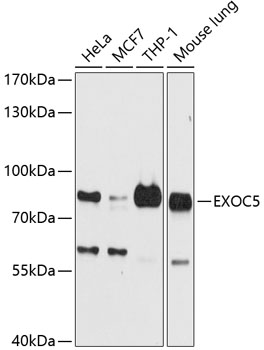 Anti-EXOC5 Polyclonal Antibody (CAB9282)