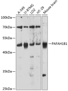 Anti-PAFAH1B1 Antibody (CAB12643)