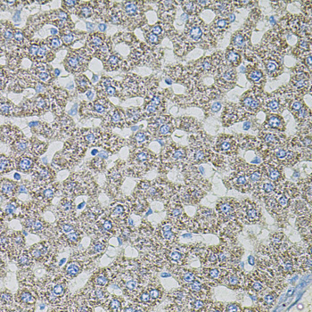 Anti-ASK1 Antibody (CAB3271)