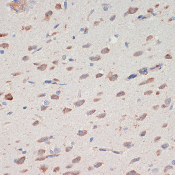 Anti-SERPINI1 Antibody (CAB15703)