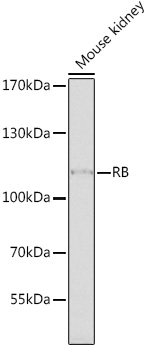 Anti-RB Antibody (CAB2116)